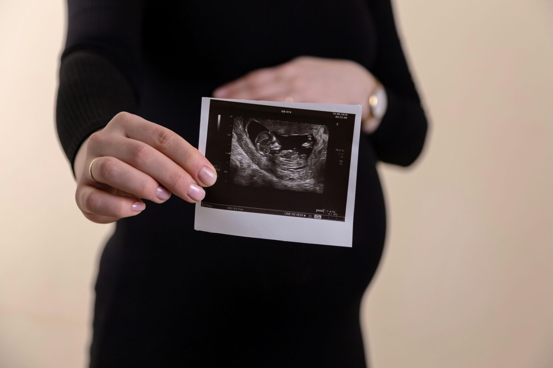Pregnant woman holding an ultrasound scan and thinking about fetal alcohol syndrome