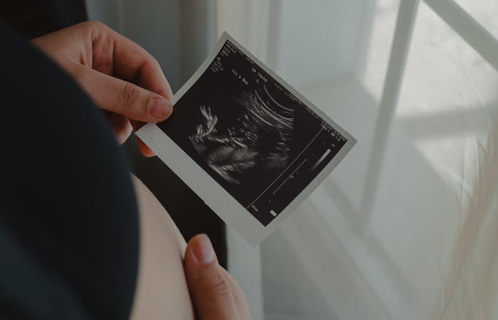 Pregnant woman holding an ultrasound scan thinking about fetal alcohol syndrome